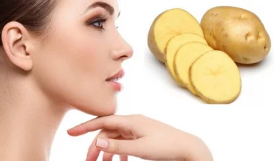 One of the best home remedies for tanned skin is potatoes